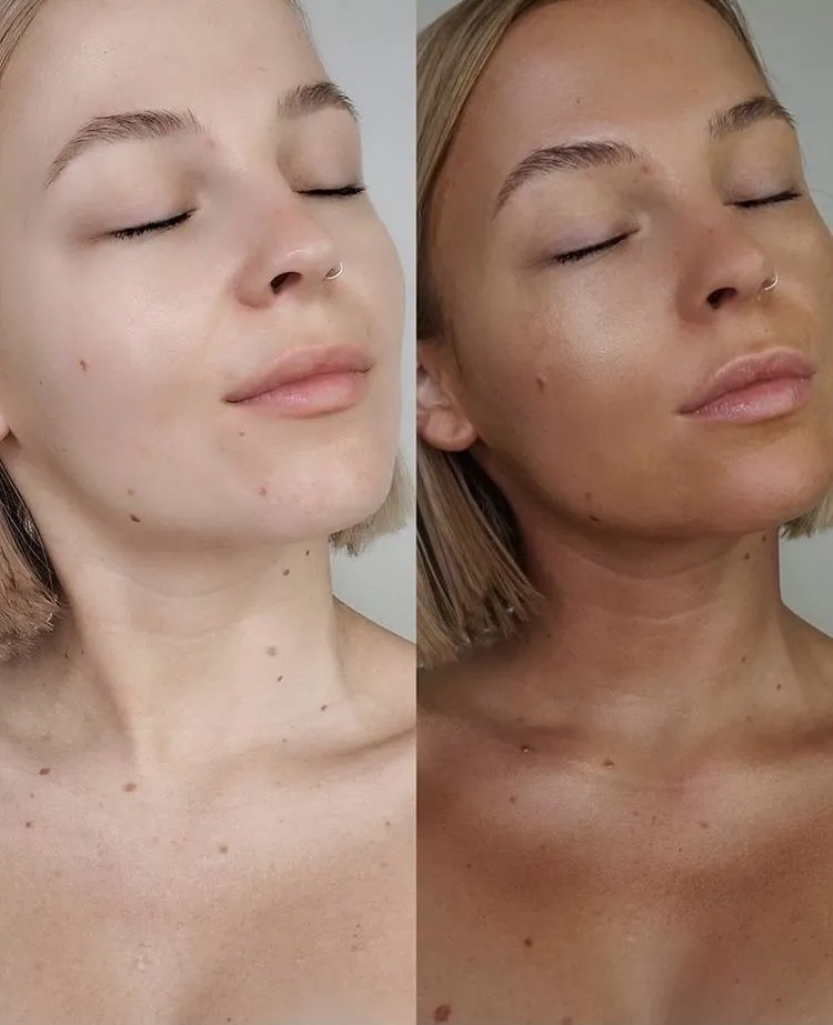 Real Glowtoure client before and after showing natural, even color on the face, neck, and décolletage