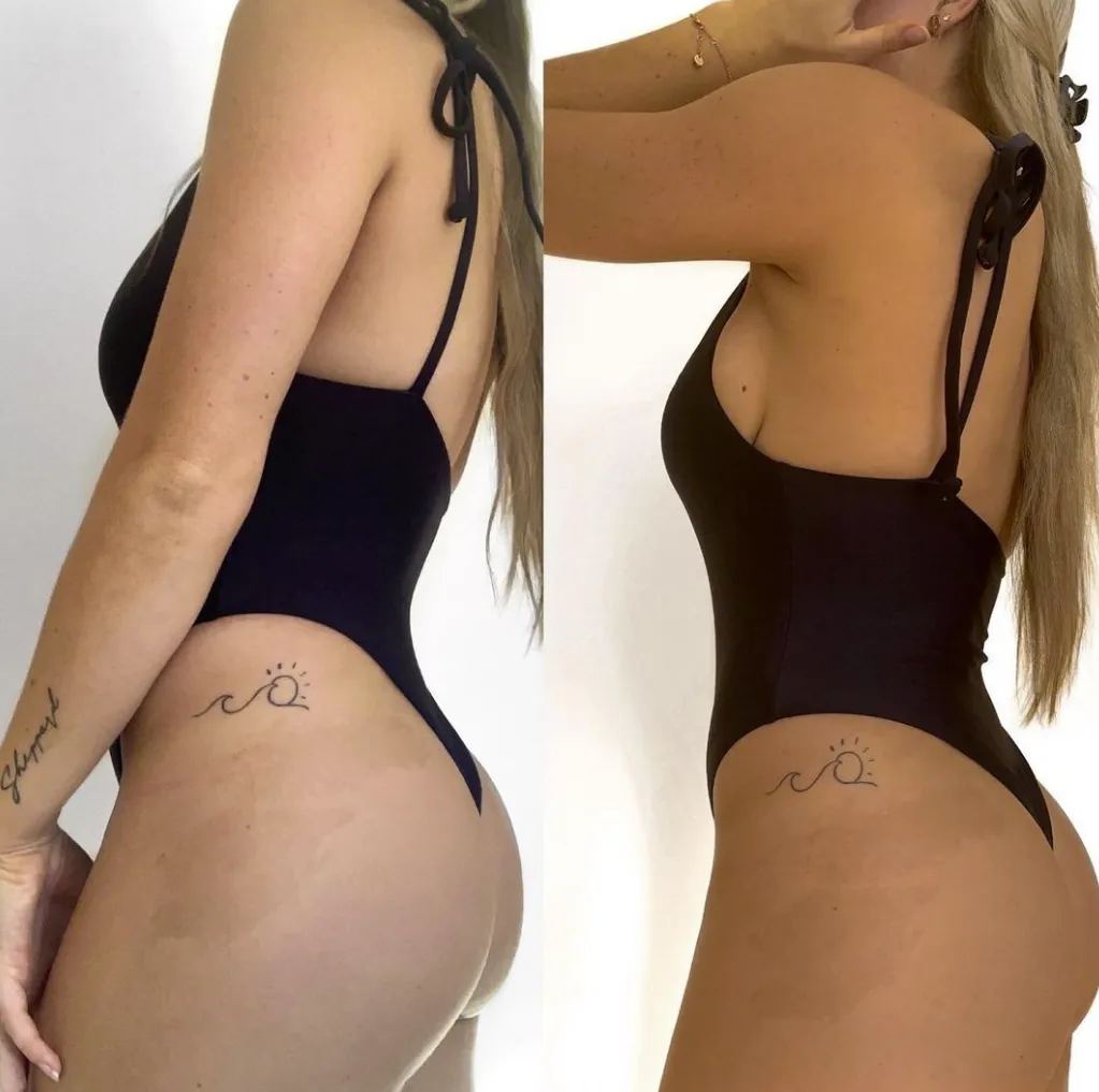 Real Glowtoure client spray tan before and after, side profile showing custom depth